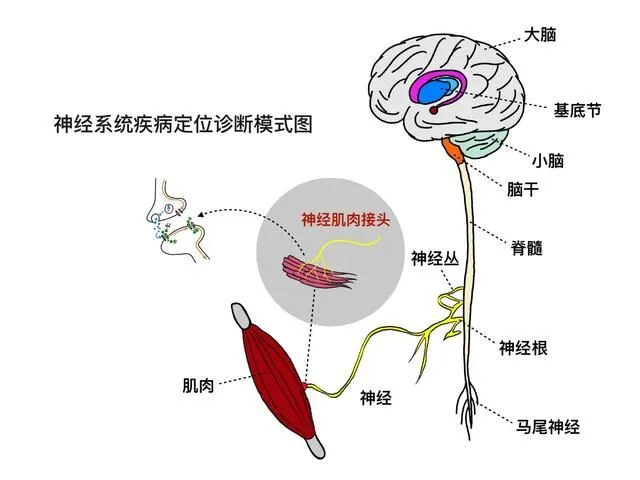 11.webp