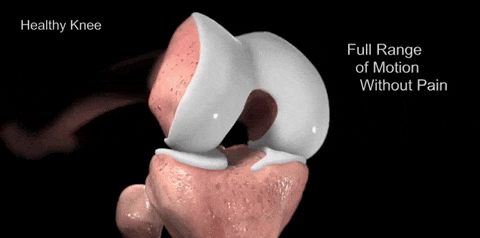 32.gif